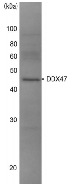 Anti-DDX47 Antibody