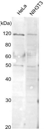 Anti-AlaRS Antibody