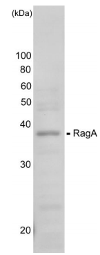 Anti-Rag A Antibody