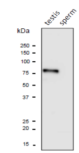 Anti-PDILT Antibody Anti-PDILT Antibody