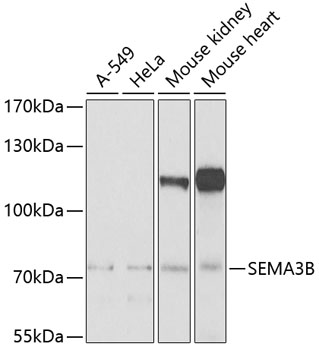 Anti-SEMA3B Antibody