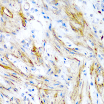 Anti-LMOD1 Antibody