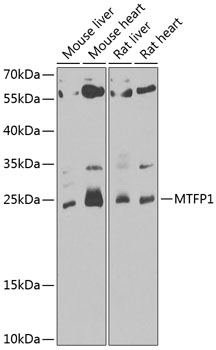 Anti-MTP18 Antibody