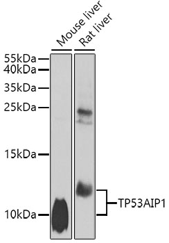 Anti-p53 AIP1 Antibody