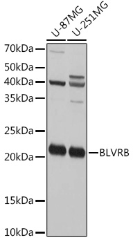 Anti-FLR Antibody