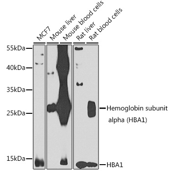 Anti-Hemoglobin subunit alpha Antibody