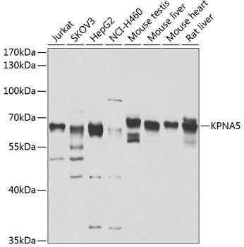 Anti-KPNA5 Antibody