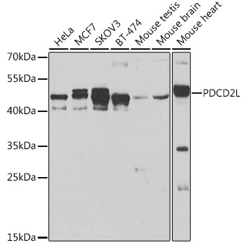 Anti-PDCD2L Antibody
