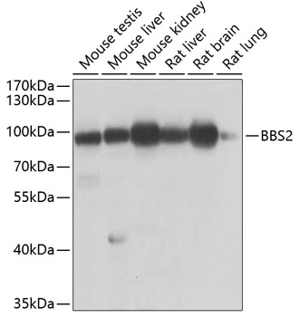 Anti-BBS2 Antibody