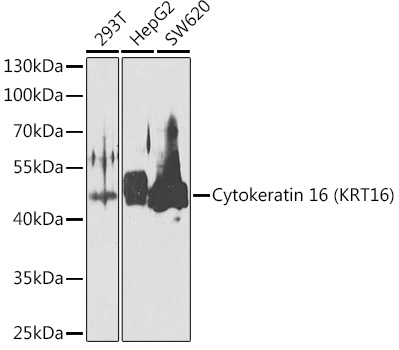 Anti-Cytokeratin 16 / K16 Antibody