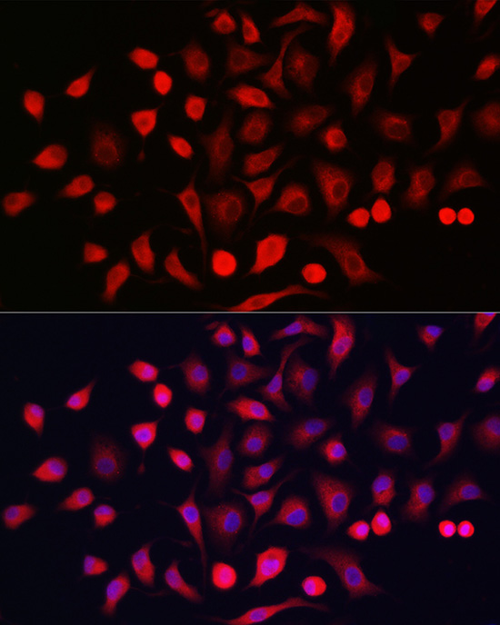 Anti-Cytokeratin 16 / K16 Antibody Anti-Cytokeratin 16 / K16 Antibody