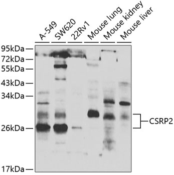 Anti-CSRP2 / Dlp1 Antibody