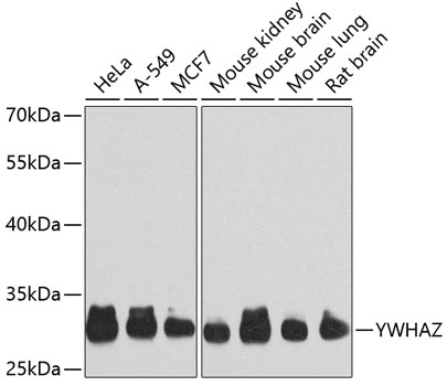 Anti-14-3-3 zeta Antibody
