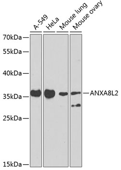 Anti-AnnexinA8 like2 Antibody