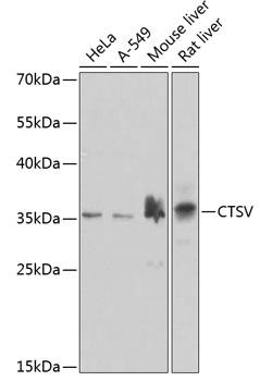 Anti-Cathepsin V Antibody