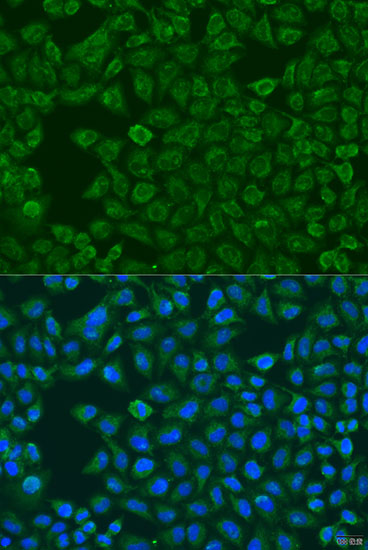 Anti-FMO5 Antibody Anti-FMO5 Antibody