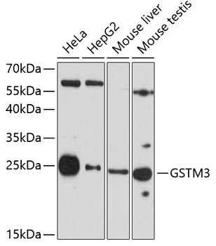Anti-GSTM3 Antibody