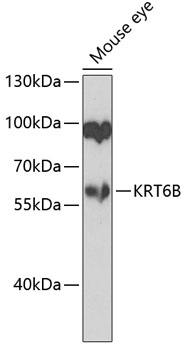 Anti-Cytokeratin 6b Antibody