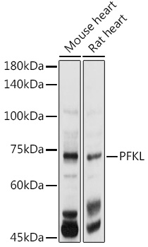 Anti-PFKL Antibody