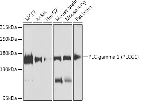 Anti-Phospholipase C gamma 1 / PLC-gamma-1 Antibody