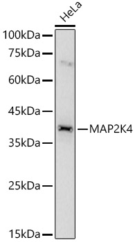 Anti-MEK4 / MKK4 Antibody Anti-MEK4 / MKK4 Antibody