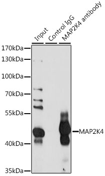 Anti-MEK4 / MKK4 Antibody Anti-MEK4 / MKK4 Antibody