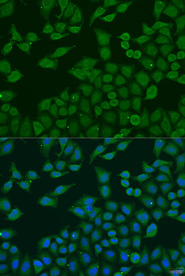 Anti-PLA2G4C Antibody