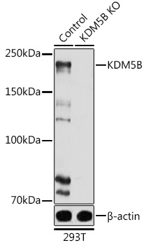 Anti-KDM5B / PLU1 / Jarid1B Antibody