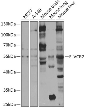 Anti-FLVCR2 Antibody