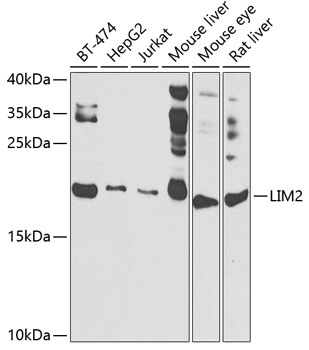 Anti-LIM2 Antibody