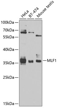Anti-Myeloid leukemia factor 1 Antibody