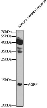 Anti-AGRP Antibody