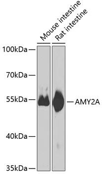 Anti-Pancreatic alpha amylase Antibody