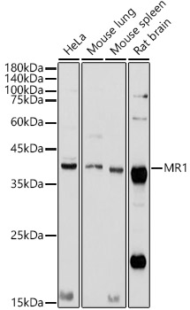 Anti-MR1 Antibody