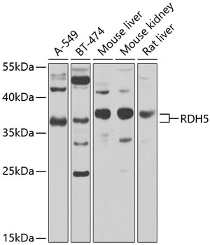 Anti-RDH5 Antibody