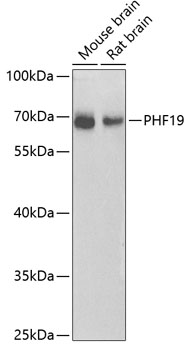 Anti-PHF19 Antibody