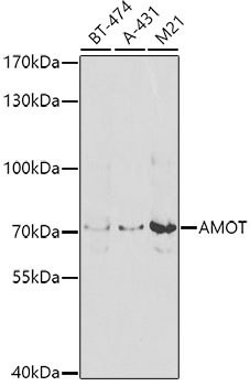 Anti-Angiomotin Antibody