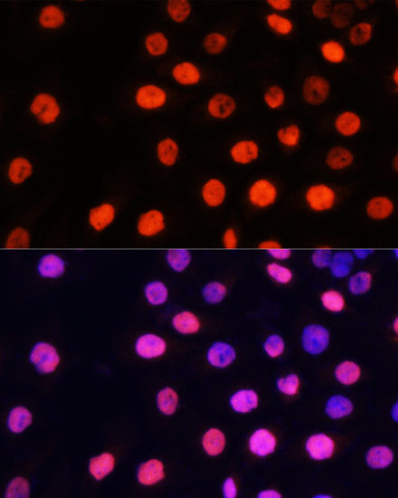 Anti-nmt55 / p54nrb (mono methyl Arg357 + Arg365) Antibody