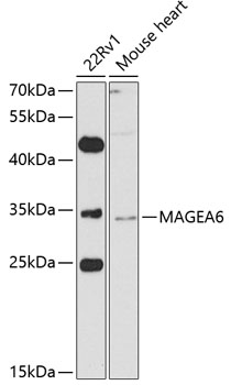 Anti-MAGEA6 Antibody