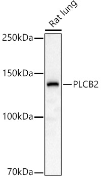 Anti-Phospholipase C beta 2 / PLCB2 Antibody