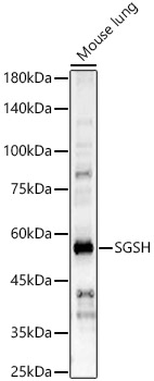 Anti-SGSH / HSS Antibody