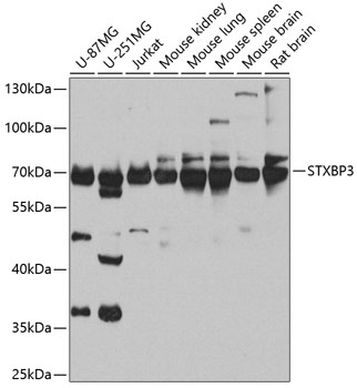 Anti-Munc18c Antibody