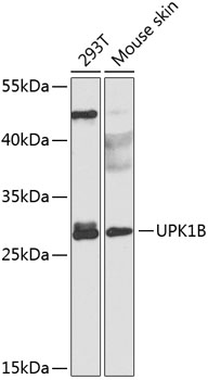 Anti-Uroplakin Ib / UPIb Antibody