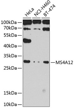 Anti-MS4A12 Antibody