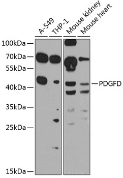 Anti-SCDGFB / PDGF-D Antibody