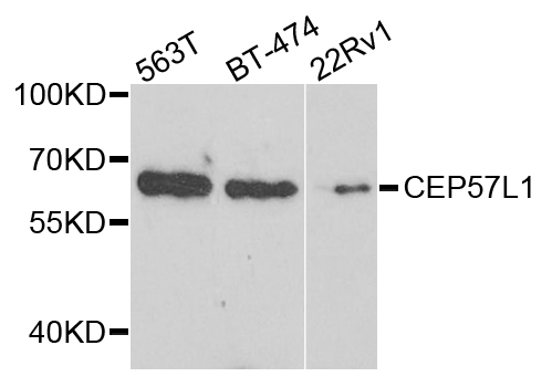Anti-CEP57L1 Antibody