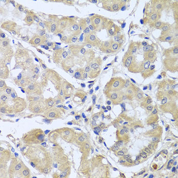 Anti-CEP57L1 Antibody Anti-CEP57L1 Antibody