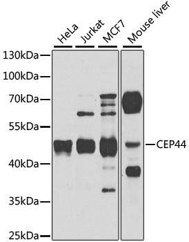 Anti-CEP44 Antibody
