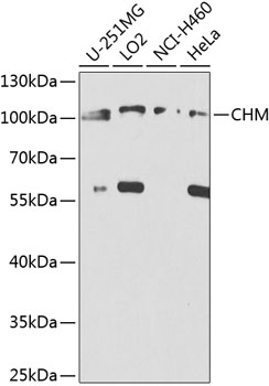 Anti-CHM Antibody