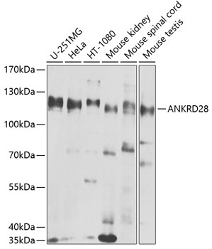 Anti-ANKRD28 Antibody